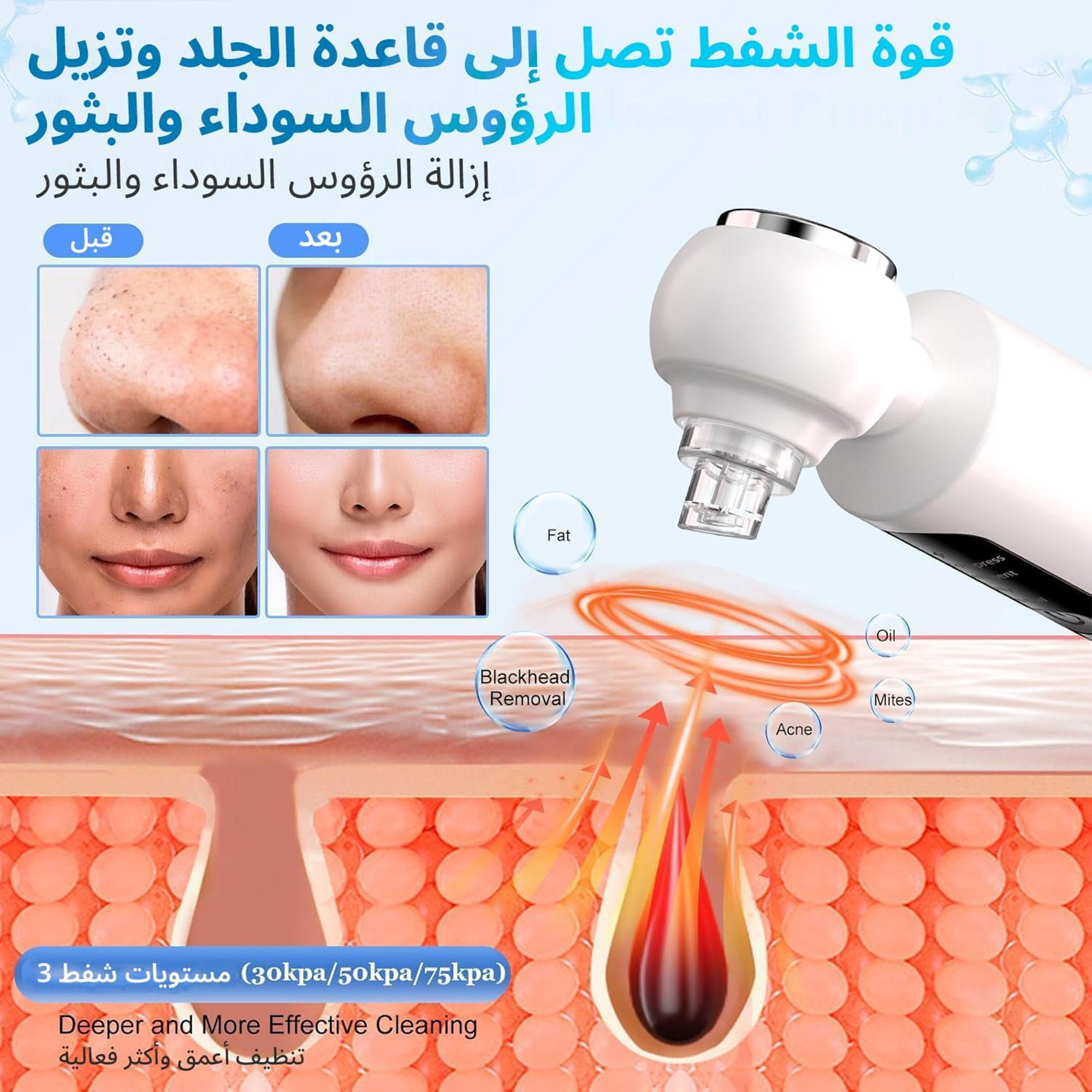 جهاز إزالة الرؤوس السوداء وشفط المسام مع 3 مستويات من الشفط - الصورة 4