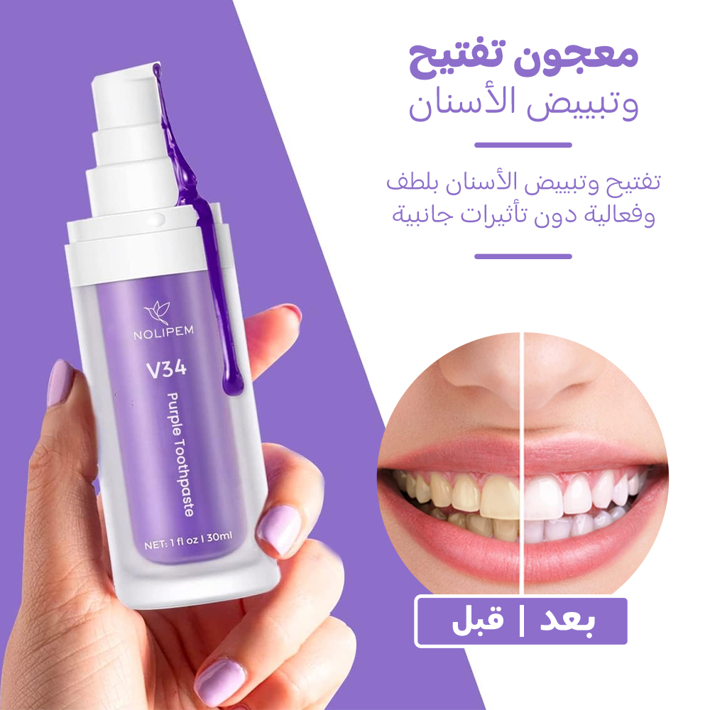 • جيل تبييض وتنظيف الاسنان السحري - الصورة 5